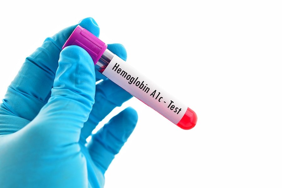 Hemoglobina glicosilada (HbA1c)